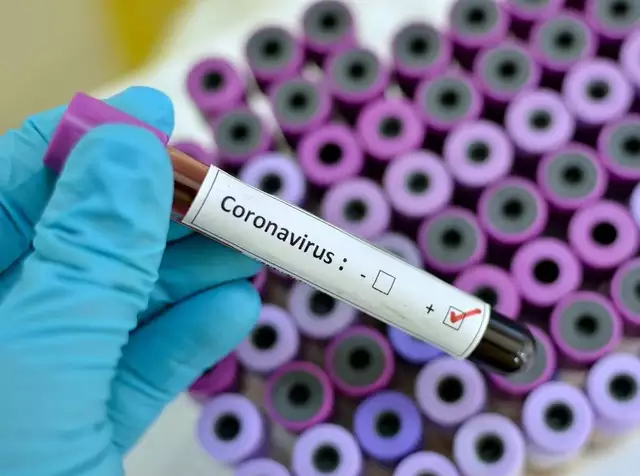 Novel Coronavirus: Is Nigeria at Risk?