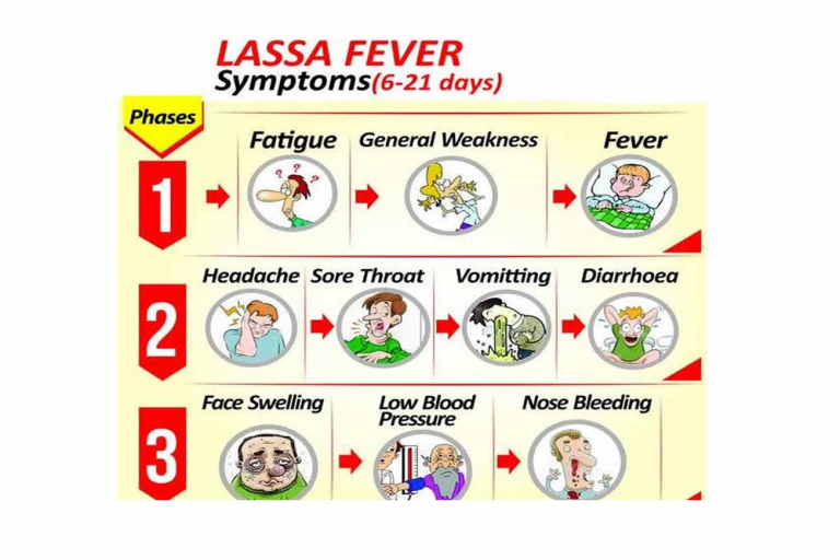 COVID-19: Why Nigeria Should be More Concerned About Lassa Fever