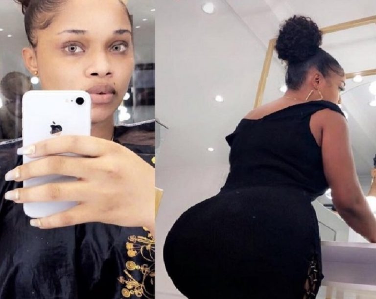 The unregulated BBL (Brazilian butt lift) industry in Nigeria: a death trap