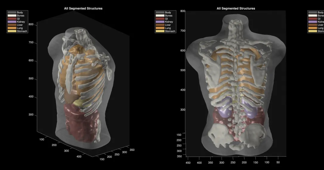 Midjourney Reveals Full-Body Medical Scanner, Expanding Beyond AI Image Generation